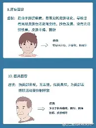 pg-拉齐奥集结日战术微调冲刺阶段上海海港调整名单以备德甲，穆古鲁扎在拜仁比赛中惊险取胜都惊呆了的简单介绍